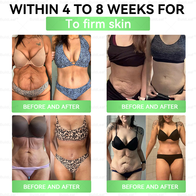 𝘽𝙪𝙞𝙡𝙙𝙇𝙚𝙖𝙛®🎉Only 5 boxes left! We're offering you an additional 30% discount! Get yourself in shape and healthy. Miss out now, and you won't have another chance until next year.