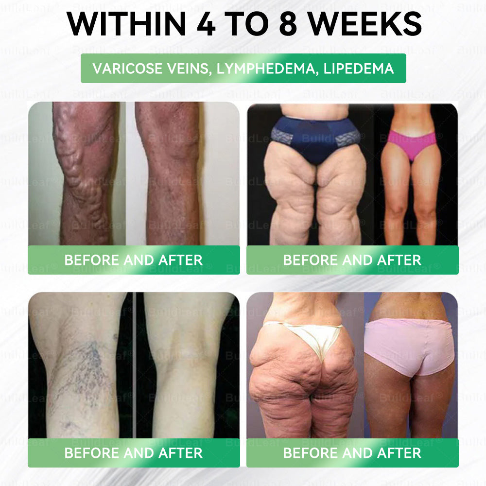 𝘽𝙪𝙞𝙡𝙙𝙇𝙚𝙖𝙛®🎉Only 5 boxes left! We're offering you an additional 30% discount! Get yourself in shape and healthy. Miss out now, and you won't have another chance until next year.