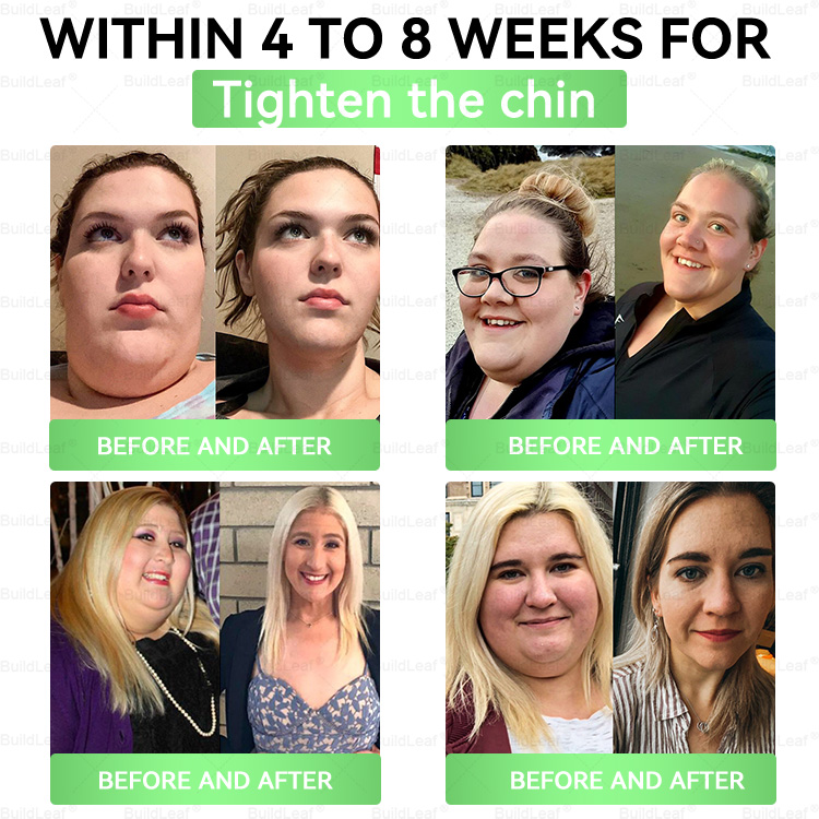 BuildLeaf®✨🎁 ABSOLUTE MADNESS! 70% OFF - Even we can't believe we're doing this! 🎁